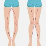 THE LEGS OF A WOMAN CAN SAY AS IT IS THEIR VAGI …