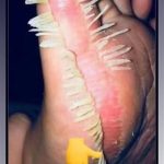 🦵Heroic Mother Sacrifices Her Own Skin to Save Son’s Life