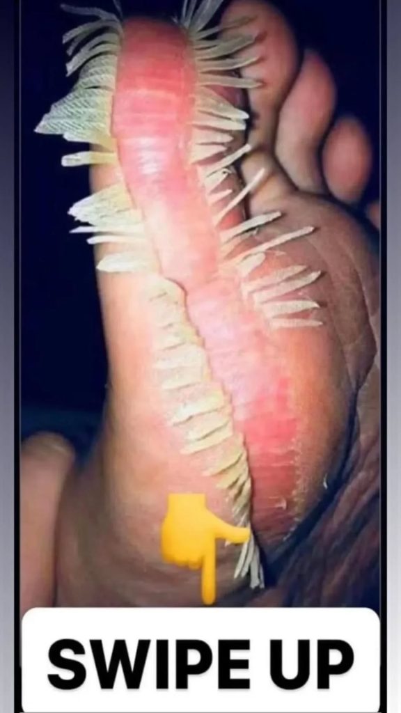 🦵Heroic Mother Sacrifices Her Own Skin to Save Son’s Life