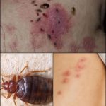 Deadly danger: the world’s most dangerous insect has emerged